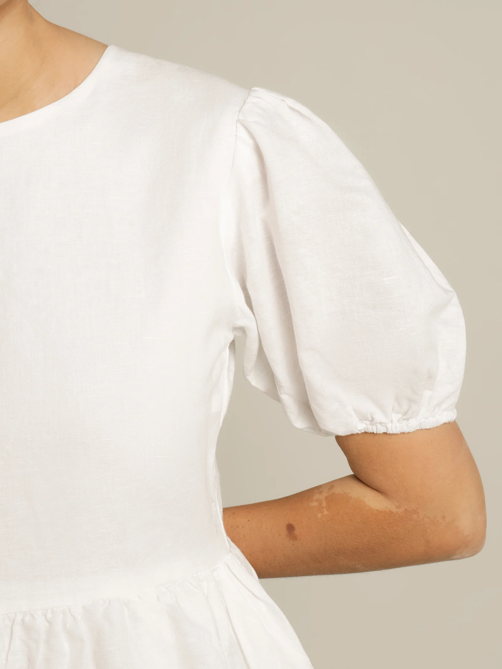 Nima Linen Mini Dress - Image 5
